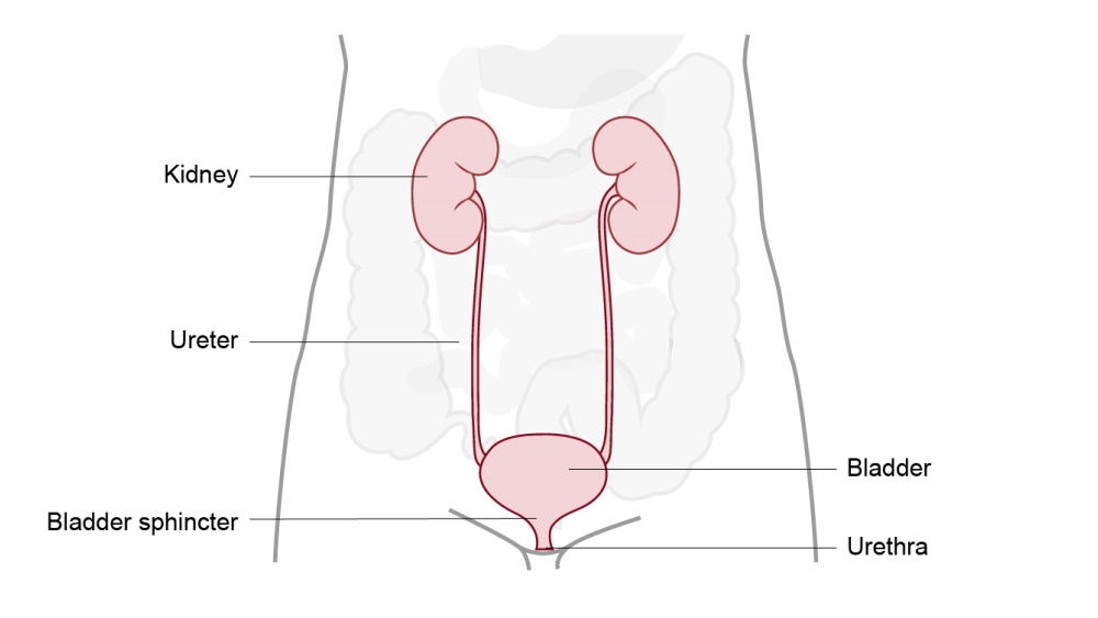 urostomy illustration