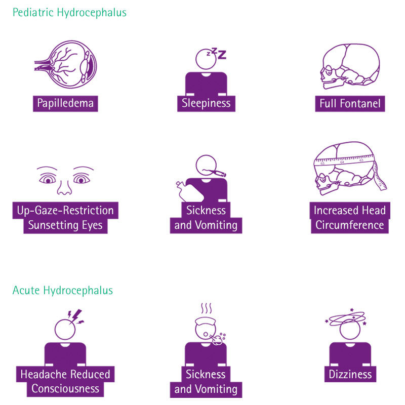 Icons for the symptoms of pediatric and acute hydrocephalus