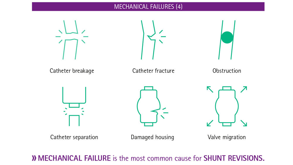 Info graph hydrocephalus shunts mechanical failures