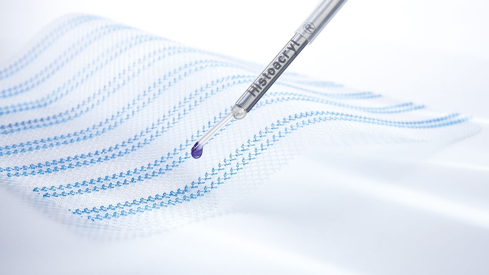 Histoacryl® LapFix surgical mesh fixation