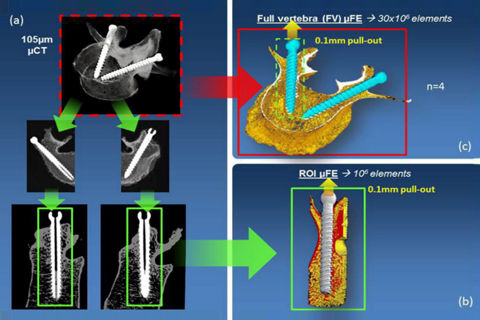 Chart about the effect of cement augmentation on pedicle screw fixation under various load cases