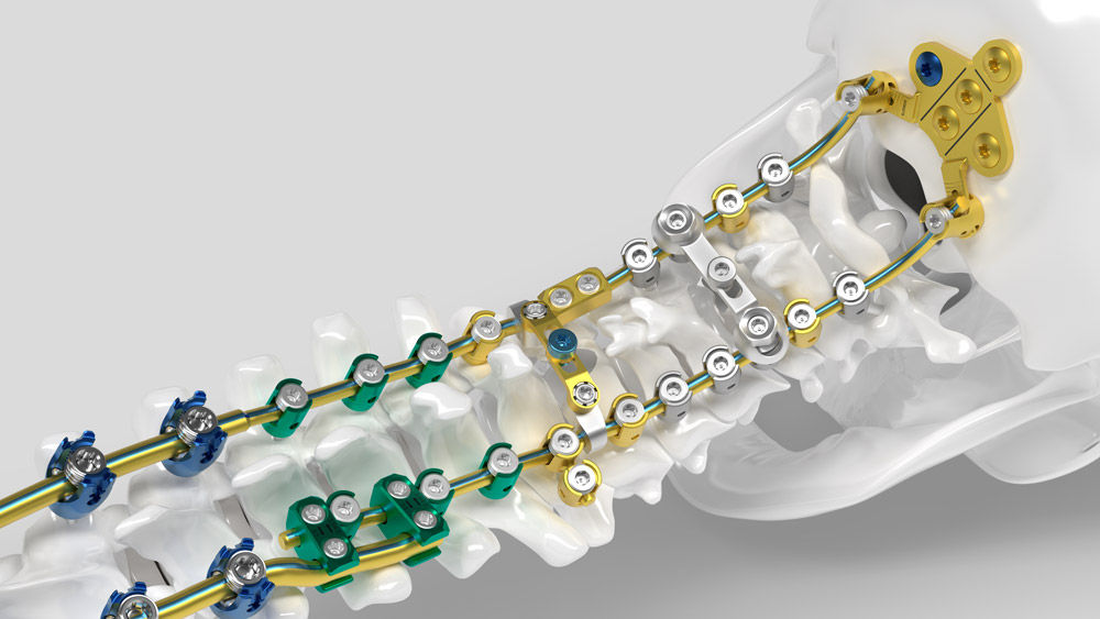 Ennovate® Cervical surgical module